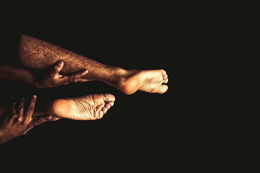 Easy Tips and Tricks to Deal with Sweaty Feet